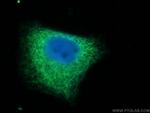 Cytokeratin 7 Antibody in Immunocytochemistry (ICC/IF)