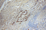 Cytokeratin 7 Antibody in Immunohistochemistry (Paraffin) (IHC (P))