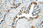 Cytokeratin 7 Antibody in Immunohistochemistry (Paraffin) (IHC (P))