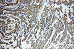 Cytokeratin 7 Antibody in Immunohistochemistry (Paraffin) (IHC (P))
