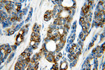 Cytokeratin 7 Antibody in Immunohistochemistry (Paraffin) (IHC (P))