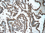 Cytokeratin 7 Antibody in Immunohistochemistry (Paraffin) (IHC (P))