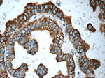 Cytokeratin 7 Antibody in Immunohistochemistry (Paraffin) (IHC (P))