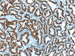 Cytokeratin 7 Antibody in Immunohistochemistry (Paraffin) (IHC (P))
