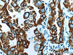 Cytokeratin 7 Antibody in Immunohistochemistry (Paraffin) (IHC (P))