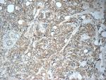 Cytokeratin 7 Antibody in Immunohistochemistry (Paraffin) (IHC (P))