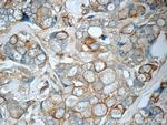 Cytokeratin 7 Antibody in Immunohistochemistry (Paraffin) (IHC (P))