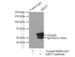 Cytokeratin 7 Antibody in Immunoprecipitation (IP)