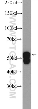 Cytokeratin 7 Antibody in Western Blot (WB)