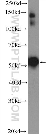 Cytokeratin 7 Antibody in Western Blot (WB)