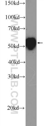 Cytokeratin 7 Antibody in Western Blot (WB)