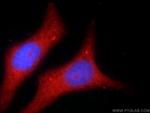 RIPK1 Antibody in Immunocytochemistry (ICC/IF)