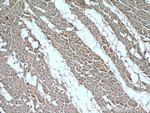 RIPK1 Antibody in Immunohistochemistry (Paraffin) (IHC (P))