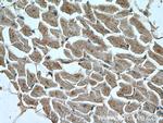 RIPK1 Antibody in Immunohistochemistry (Paraffin) (IHC (P))