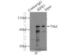 RIPK1 Antibody in Immunoprecipitation (IP)
