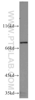 RIPK1 Antibody in Western Blot (WB)