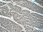RIPK1 Antibody in Immunohistochemistry (Paraffin) (IHC (P))