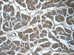 RIPK1 Antibody in Immunohistochemistry (Paraffin) (IHC (P))