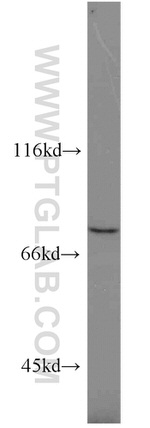 RIPK1 Antibody in Western Blot (WB)