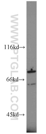 RIPK1 Antibody in Western Blot (WB)