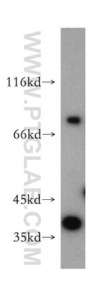 RIPK1 Antibody in Western Blot (WB)