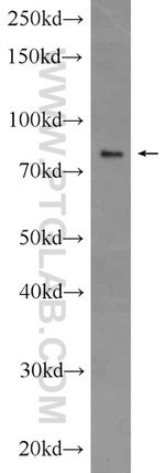 RIPK1 Antibody in Western Blot (WB)