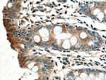 ACADL Antibody in Immunohistochemistry (Paraffin) (IHC (P))