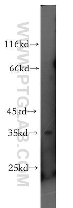 RNASEH2B Antibody in Western Blot (WB)