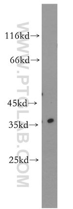 RNASEH2B Antibody in Western Blot (WB)