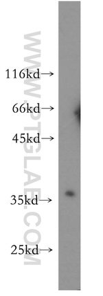RNASEH2B Antibody in Western Blot (WB)