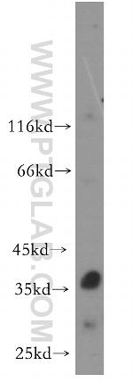 RNASEH2B Antibody in Western Blot (WB)