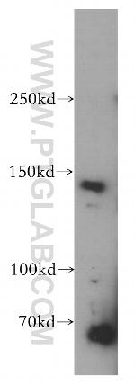 POLR3A Antibody in Western Blot (WB)