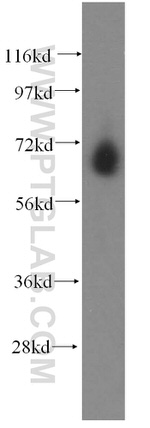 CTDSPL2 Antibody in Western Blot (WB)