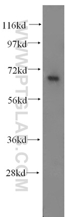 CTDSPL2 Antibody in Western Blot (WB)