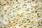 DNAI2 Antibody in Immunohistochemistry (Paraffin) (IHC (P))