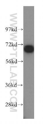 DNAI2 Antibody in Western Blot (WB)