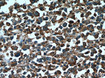 PARP9 Antibody in Immunohistochemistry (Paraffin) (IHC (P))