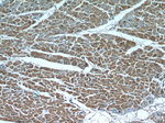 PARP9 Antibody in Immunohistochemistry (Paraffin) (IHC (P))