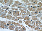 PARP9 Antibody in Immunohistochemistry (Paraffin) (IHC (P))