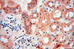 PARP9 Antibody in Immunohistochemistry (Paraffin) (IHC (P))