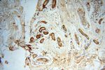 PARP9 Antibody in Immunohistochemistry (Paraffin) (IHC (P))