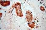 PARP9 Antibody in Immunohistochemistry (Paraffin) (IHC (P))