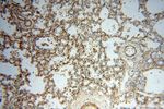 PARP9 Antibody in Immunohistochemistry (Paraffin) (IHC (P))