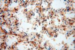 PARP9 Antibody in Immunohistochemistry (Paraffin) (IHC (P))