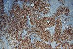 PARP9 Antibody in Immunohistochemistry (Paraffin) (IHC (P))