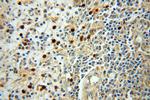 PARP9 Antibody in Immunohistochemistry (Paraffin) (IHC (P))