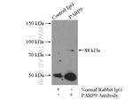 PARP9 Antibody in Immunoprecipitation (IP)
