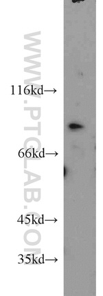 PARP9 Antibody in Western Blot (WB)