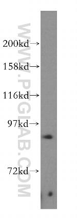 PARP9 Antibody in Western Blot (WB)