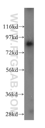PARP9 Antibody in Western Blot (WB)